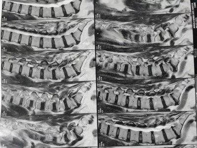 AJUDA P/CIRURGIA DA ÂNGELA.