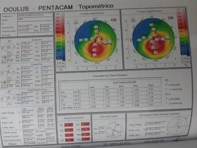 Me ajude a não perder a visao