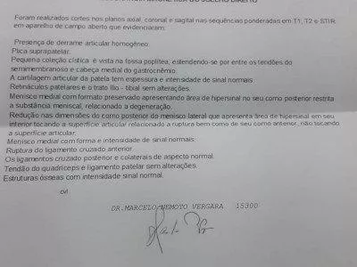 Ajuda para cirurgia ruptura de ligamento do joelho