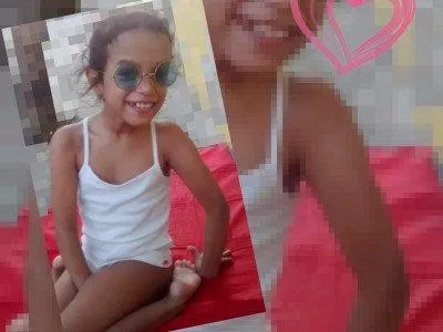 A comprá da cadeirinha e das prótese